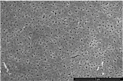 超高分子量ポリエチレン微多孔膜